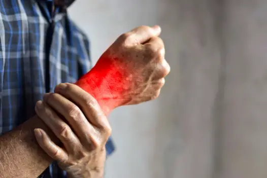 Complex Regional Pain Syndrome