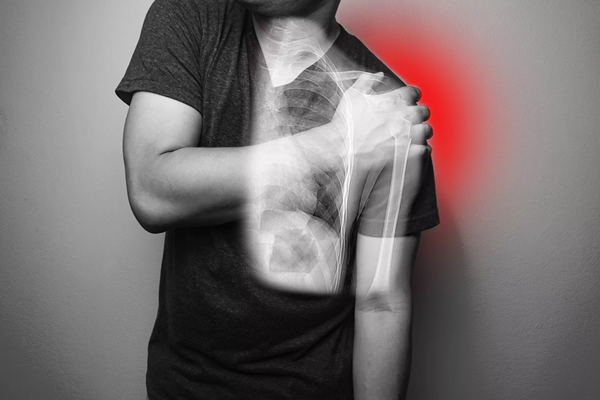 Treatment for CRPS