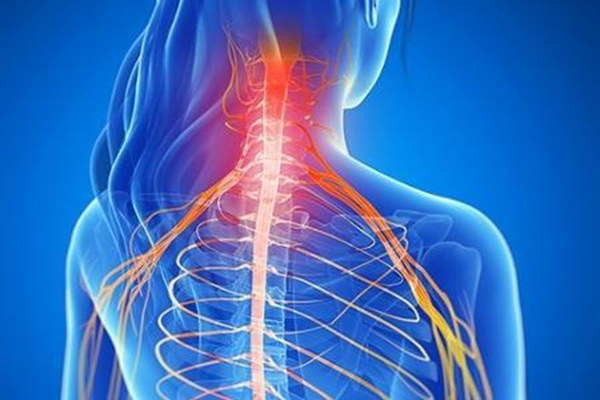 cannabis strains for compressed and pinched nerves