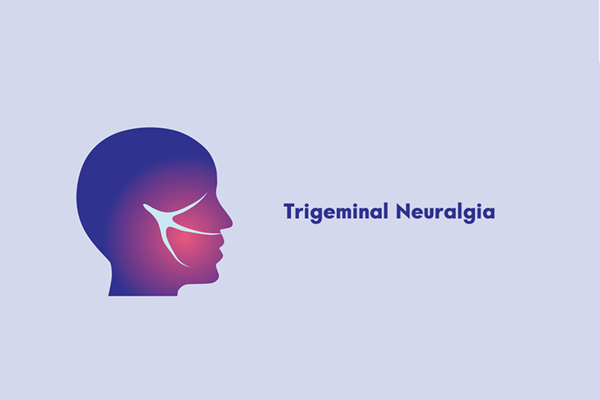 How Cannabis Strains Can Help Relieve Trigeminal Neuralgia Pain