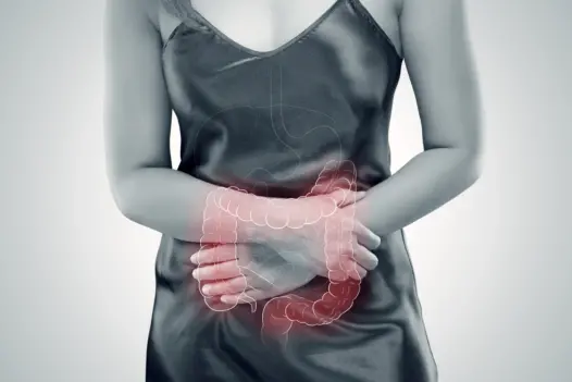 Ulcerative Colitis