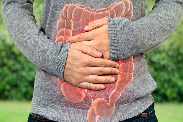 ulcerative colitis